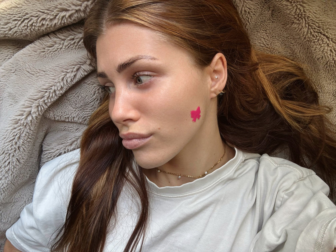 How to Get Rid of Hormonal Acne Naturally: A Science Guide